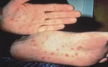 团生活活动总结8篇